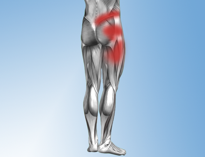 Hip Alignment Motion Dysfunction