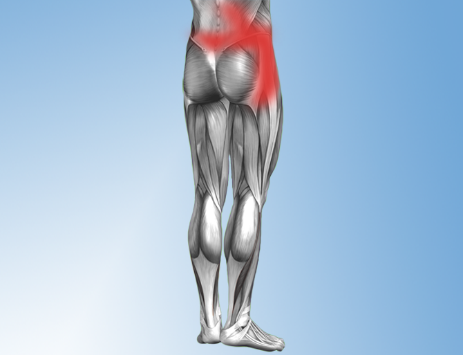 Lumbar Hip Referral